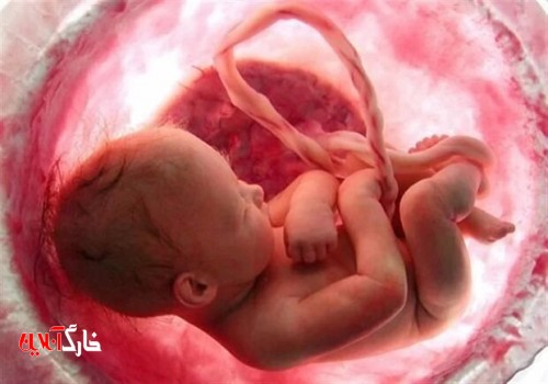 سقط جنین غیرقانونی موجب ابطال پروانه پزشکی می‌شود