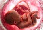 سقط جنین غیرقانونی موجب ابطال پروانه پزشکی می‌شود